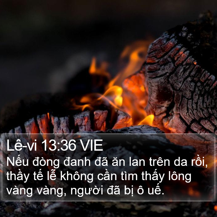 Lê-vi 13:36 VIE Bible Study