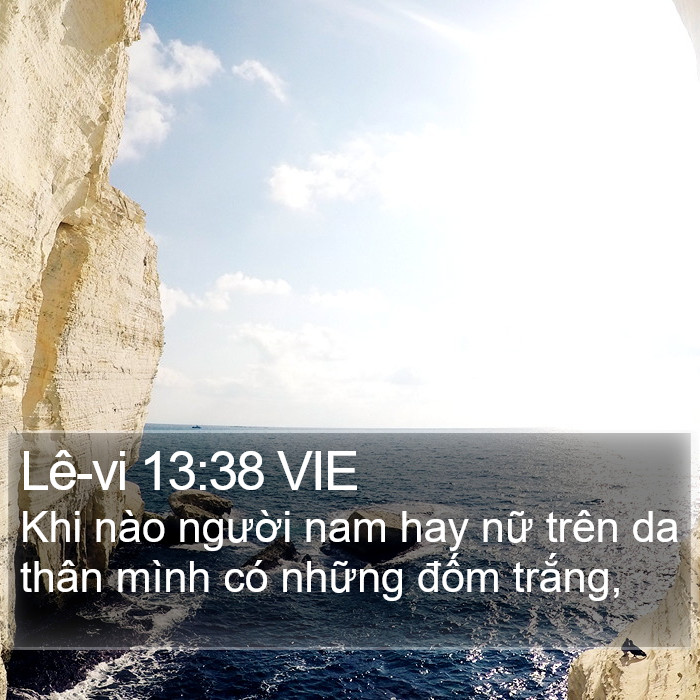 Lê-vi 13:38 VIE Bible Study