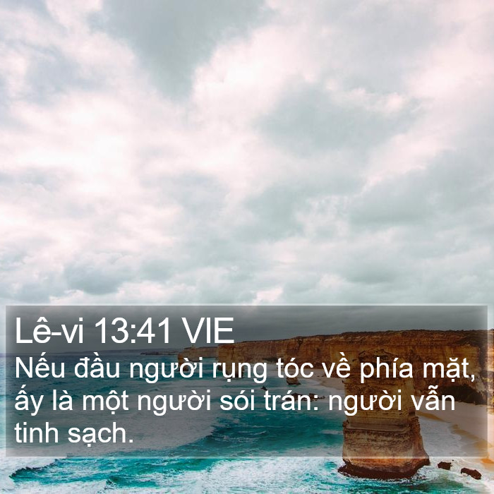 Lê-vi 13:41 VIE Bible Study